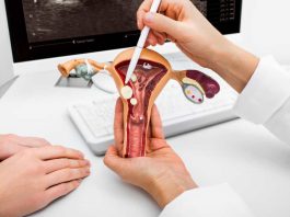 Cáncer cervicouterino expertos convocan a periodistas para fortalecer la cobertura en salud pública