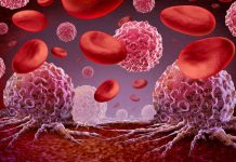 Herramienta de IA de Mayo Clinic encuentra signos tempranos de mutaciones sanguíneas relacionadas con el cáncer y las enfermedades cardíacas