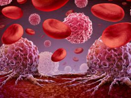 Herramienta de IA de Mayo Clinic encuentra signos tempranos de mutaciones sanguíneas relacionadas con el cáncer y las enfermedades cardíacas