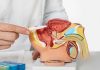 Metformina: beneficios y limitaciones en cáncer de próstata metastásico