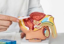 Metformina: beneficios y limitaciones en cáncer de próstata metastásico