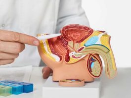 Metformina: beneficios y limitaciones en cáncer de próstata metastásico
