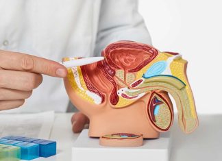 Metformina: beneficios y limitaciones en cáncer de próstata metastásico