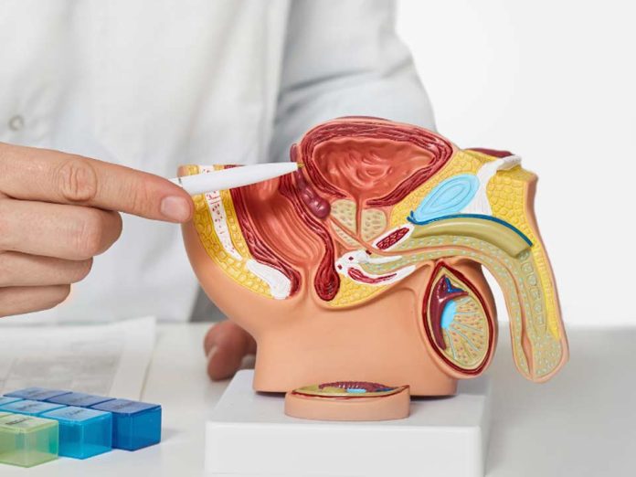 Metformina: beneficios y limitaciones en cáncer de próstata metastásico