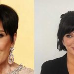 ¿Qué es el Hollywood Lift? El secreto para rejuvenecer de las celebridades llega a Chile