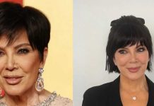 ¿Qué es el Hollywood Lift? El secreto para rejuvenecer de las celebridades llega a Chile