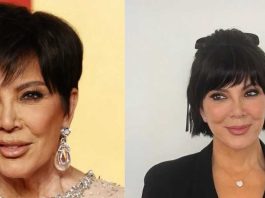 ¿Qué es el Hollywood Lift? El secreto para rejuvenecer de las celebridades llega a Chile