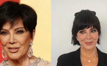 ¿Qué es el Hollywood Lift? El secreto para rejuvenecer de las celebridades llega a Chile