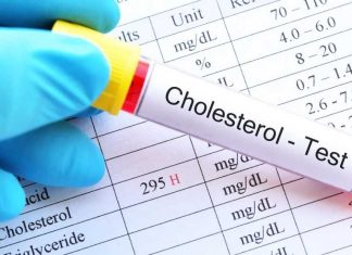 Colesterol: lo que dicen los exámenes más allá de un número