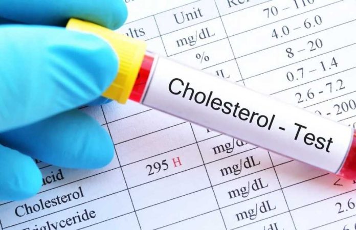 Colesterol: lo que dicen los exámenes más allá de un número