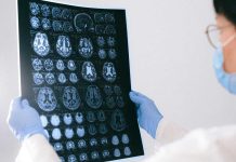 Tu cerebro nunca descansa: así puedes cuidarlo