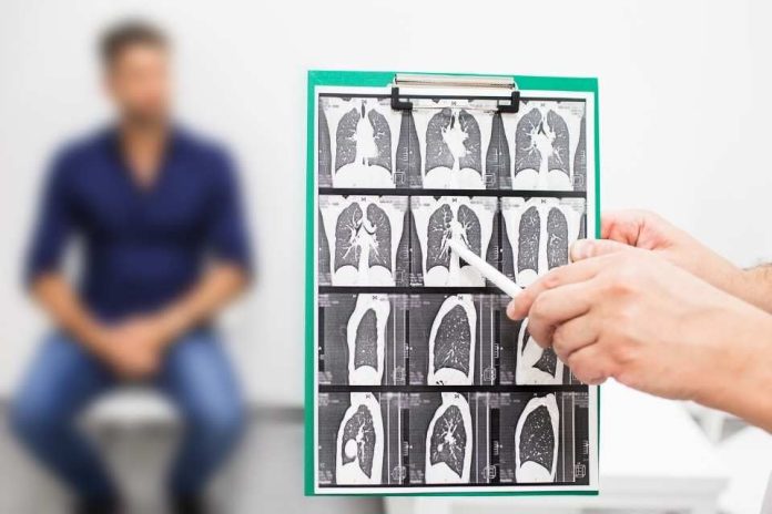 Fibrosis Pulmonar Idiopática: Cuando respirar se vuelve un desafío