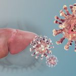 Hepatitis: la infección que avanza en silencio y puede ser mortal