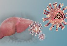 Hepatitis: la infección que avanza en silencio y puede ser mortal