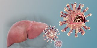 Hepatitis: la infección que avanza en silencio y puede ser mortal