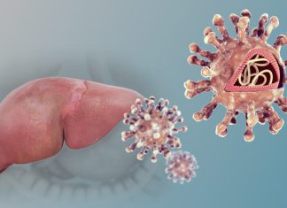 Hepatitis: la infección que avanza en silencio y puede ser mortal