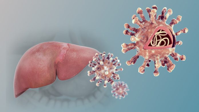 Hepatitis: la infección que avanza en silencio y puede ser mortal