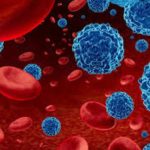 Leucemia mieloide aguda: urgencia nacional por mejorar el diagnóstico y acceso a tratamientos para pacientes