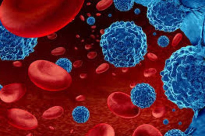 Leucemia mieloide aguda: urgencia nacional por mejorar el diagnóstico y acceso a tratamientos para pacientes