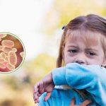 Preocupación por altos contagios de coqueluche: Síntomas y cómo prevenir esta peligrosa enfermedad