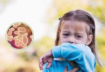 Preocupación por altos contagios de coqueluche: Síntomas y cómo prevenir esta peligrosa enfermedad