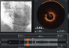 Ultreon 2.0 llega a Chile: la innovadora tecnología de inteligencia artificial para combatir las enfermedades cardiovasculares