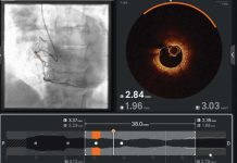 Ultreon 2.0 llega a Chile: la innovadora tecnología de inteligencia artificial para combatir las enfermedades cardiovasculares