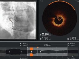 Ultreon 2.0 llega a Chile: la innovadora tecnología de inteligencia artificial para combatir las enfermedades cardiovasculares