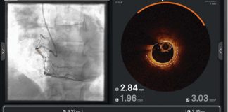 Ultreon 2.0 llega a Chile: la innovadora tecnología de inteligencia artificial para combatir las enfermedades cardiovasculares