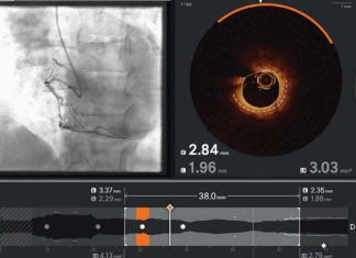 Ultreon 2.0 llega a Chile: la innovadora tecnología de inteligencia artificial para combatir las enfermedades cardiovasculares