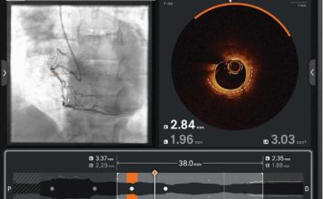Ultreon 2.0 llega a Chile: la innovadora tecnología de inteligencia artificial para combatir las enfermedades cardiovasculares
