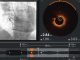Ultreon 2.0 llega a Chile: la innovadora tecnología de inteligencia artificial para combatir las enfermedades cardiovasculares