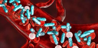 La sepsis no espera: Cómo actuar rápido frente a una infección generalizada