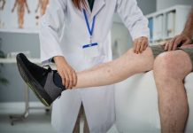¿Piernas pesadas? No es solo cansancio: podría ser insuficiencia venosa crónica