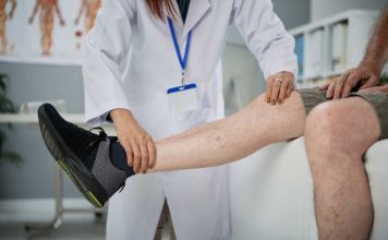¿Piernas pesadas? No es solo cansancio: podría ser insuficiencia venosa crónica