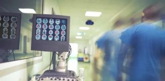 ACV: prevenir también es una responsabilidad política