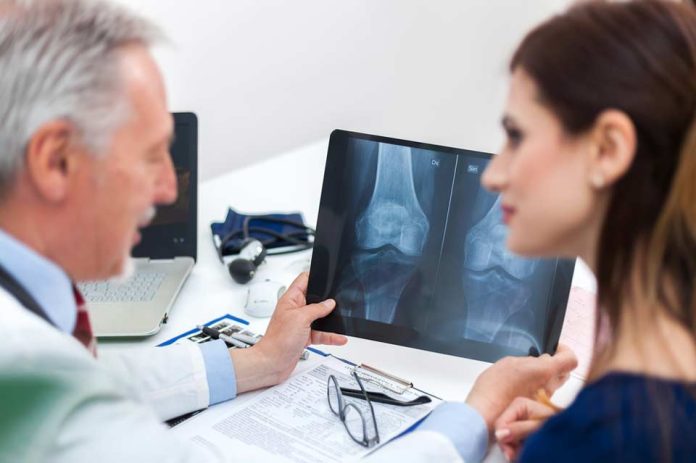 Día Mundial de la Osteoporosis: Experto explica los mitos y verdades de esta silenciosa enfermedad