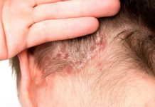 El efecto dominó más allá de la piel El efecto dominó más allá de la piel