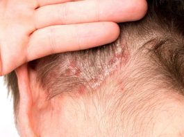 El efecto dominó más allá de la piel