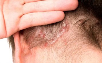 El efecto dominó más allá de la piel El efecto dominó más allá de la piel