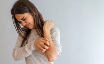 Encuesta revela grave impacto económico y desconocimiento en tratamientos para la Psoriasis Encuesta revela grave impacto económico y desconocimiento en tratamientos para la Psoriasis