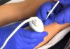 Hospital Roberto del Río utiliza bótox para transformar la movilidad de niños con parálisis cerebral