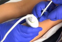 Hospital Roberto del Río utiliza bótox para transformar la movilidad de niños con parálisis cerebral