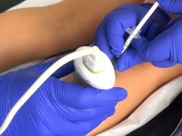 Hospital Roberto del Río utiliza bótox para transformar la movilidad de niños con parálisis cerebral