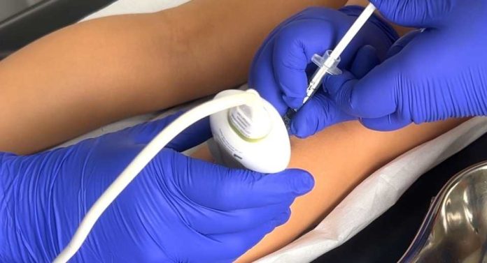 Hospital Roberto del Río utiliza bótox para transformar la movilidad de niños con parálisis cerebral