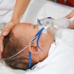 Hospital de Niños Dr. Roberto del Río destaca la importancia de la anestesia pediátrica en la atención segura y humanizada de los niños y niñas