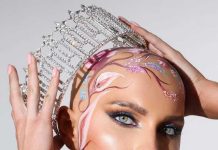 Qué es la alopecia universal femenina, la condición de la Miss Estados Unidos que emocionó al mundo al desfilar sin peluca