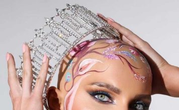 Qué es la alopecia universal femenina, la condición de la Miss Estados Unidos que emocionó al mundo al desfilar sin peluca Qué es la alopecia universal femenina, la condición de la Miss Estados Unidos que emocionó al mundo al desfilar sin peluca