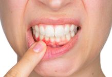 Alta mortalidad del cáncer oral puede prevenirse con controles odontológicos y autoexamen mensual Alta mortalidad del cáncer oral puede prevenirse con controles odontológicos y autoexamen mensual