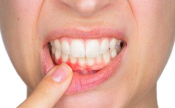 Alta mortalidad del cáncer oral puede prevenirse con controles odontológicos y autoexamen mensual Alta mortalidad del cáncer oral puede prevenirse con controles odontológicos y autoexamen mensual